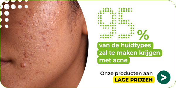 https://www.multipharma.be/dw/image/v2/BDGN_PRD/on/demandware.static/-/Library-Sites-MultipharmaSharedLibrary/default/dw2c99fc96/Home/Category%20Landing%20Pages/Acne%20behandeling/eczema-acne-hp-600x300-nl.png