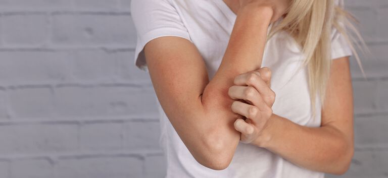 https://www.multipharma.be/dw/image/v2/BDGN_PRD/on/demandware.static/-/Library-Sites-MultipharmaSharedLibrary/default/dw48f8ee65/eczema-article-3.jpg?sw=768&sfrm=png