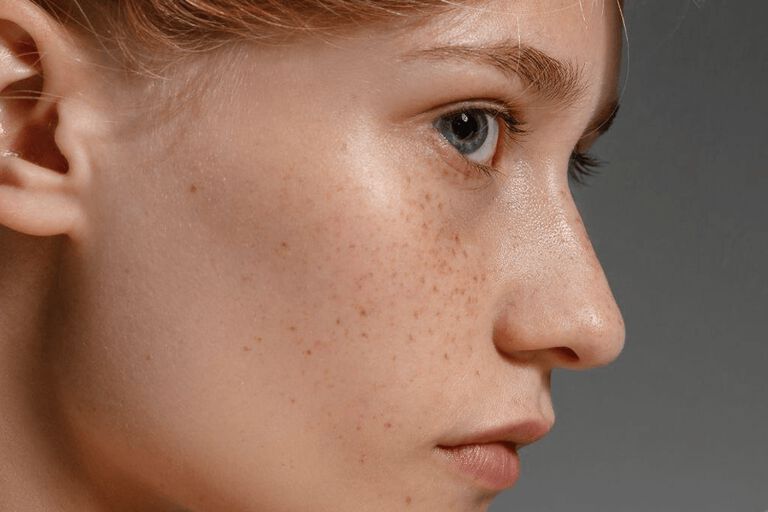 https://www.multipharma.be/dw/image/v2/BDGN_PRD/on/demandware.static/-/Library-Sites-MultipharmaSharedLibrary/default/dw4925cca2/Home/blog/Seasonal-Campaigns/2023-1-skin/981x654-beaute.jpg?sw=768&sfrm=png