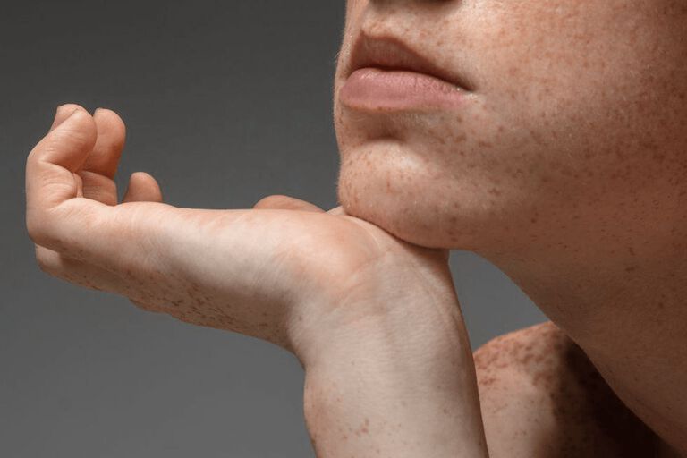 https://www.multipharma.be/dw/image/v2/BDGN_PRD/on/demandware.static/-/Library-Sites-MultipharmaSharedLibrary/default/dwfc0a5c2c/Home/blog/Seasonal-Campaigns/2023-1-skin/981x654-psy.jpg?sw=768&sfrm=png
