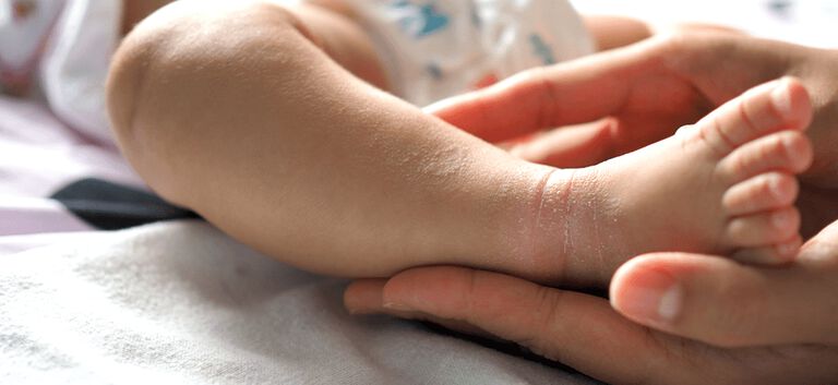 https://www.multipharma.be/dw/image/v2/BDGN_PRD/on/demandware.static/-/Library-Sites-MultipharmaSharedLibrary/fr_BE/dwa23df9ce/981x451_peau%20seche%20bebe.jpg?sw=768&sfrm=png