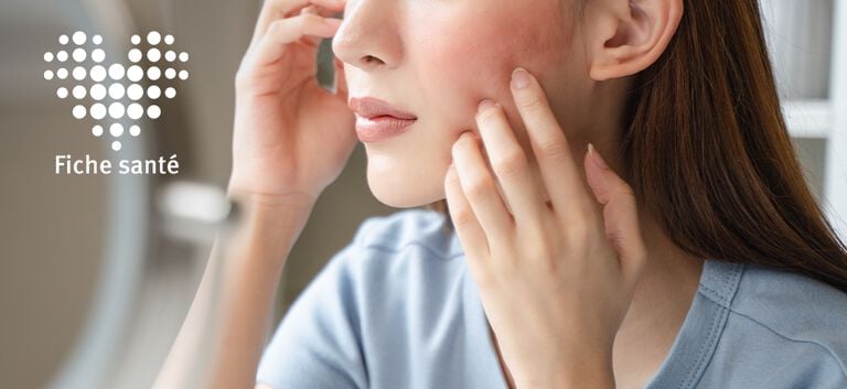 https://www.multipharma.be/dw/image/v2/BDGN_PRD/on/demandware.static/-/Library-Sites-MultipharmaSharedLibrary/fr_BE/dwd058b79d/Home/Health%20Issues/dermato/eczéma/fs-eczema-981x451-fr.jpg?sw=768&sfrm=png