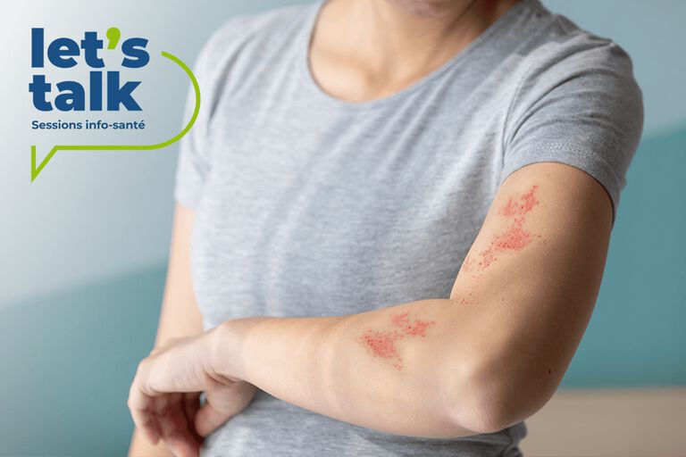 https://www.multipharma.be/dw/image/v2/BDGN_PRD/on/demandware.static/-/Library-Sites-MultipharmaSharedLibrary/fr_BE/dwf553819f/Blog/HealthCommunity/Let's%20Talk%202025/lt-peau-981x654-fr.jpg?sw=768&sfrm=png