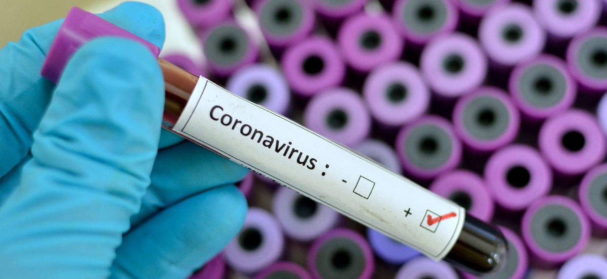 /on/demandware.static/-/Library-Sites-MultipharmaSharedLibrary/default/dw97cbfeff/Home/blog/Coronavirus/coronavirus_lp.jpg