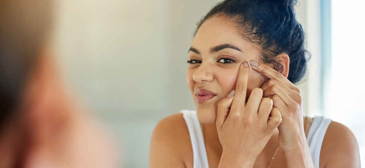 Acné: comment prendre soin de sa peau ?